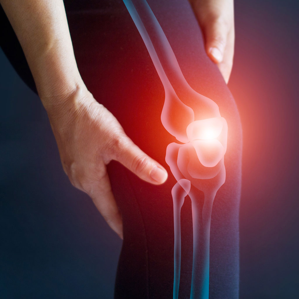Knee Pain Image