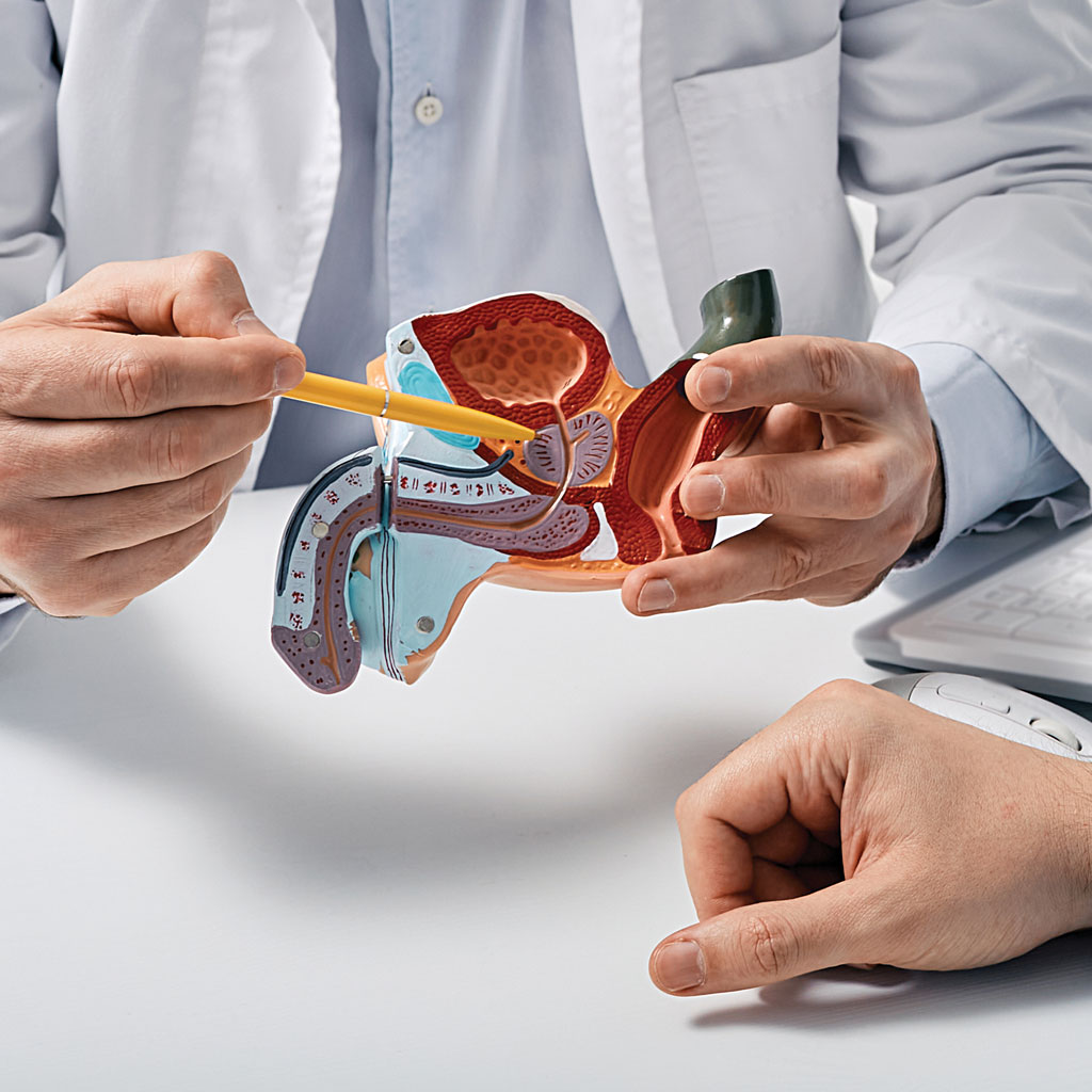 Doctor Showing Signs of an Enlarged Prostate on Model